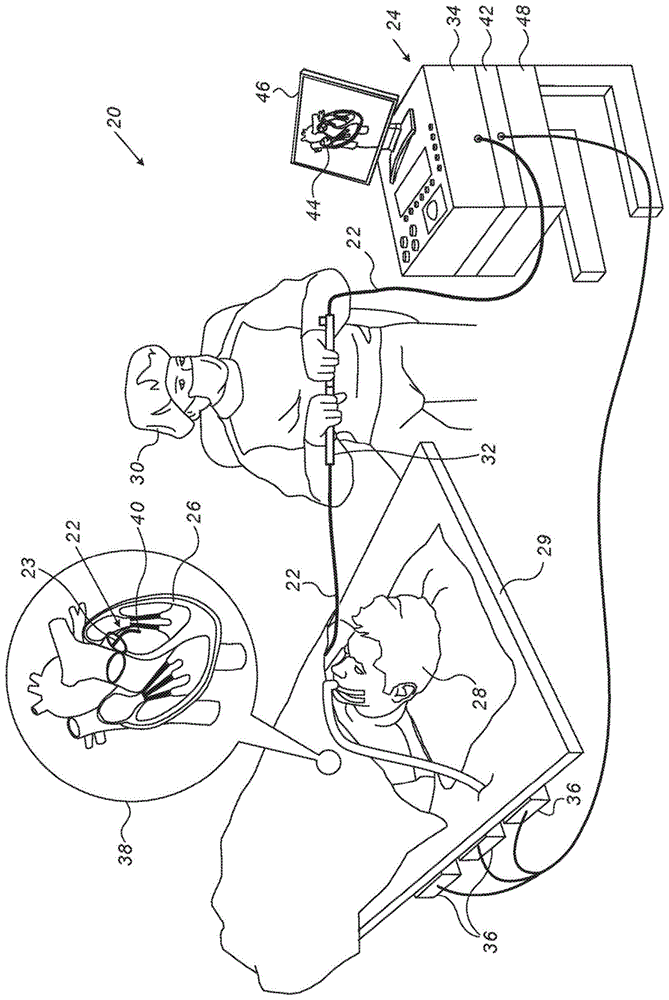 可偏转医疗探头的制作方法