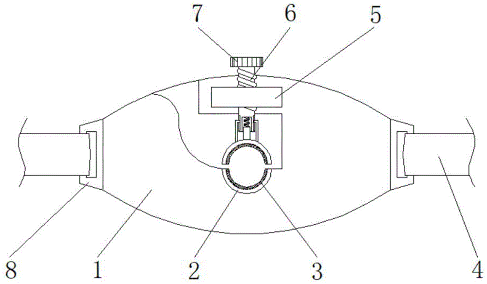 一种重症急救病人用气管插管固定器的制作方法