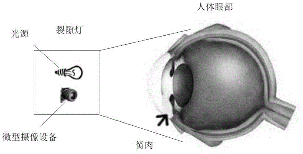 眼部胬肉检测定位系统的制作方法