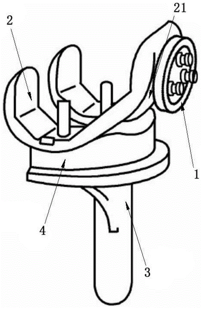 一种仿生设计的全膝关节的制作方法