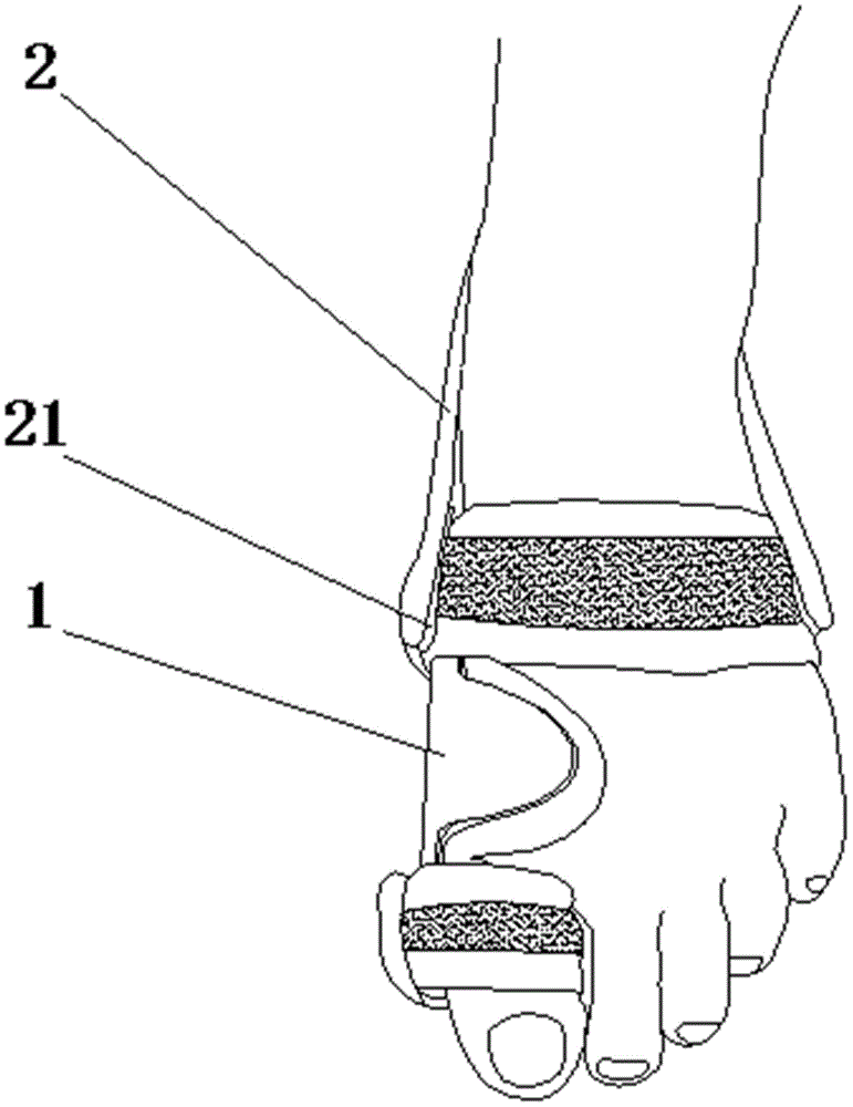 一种骨外科用脚趾矫正装置的制作方法