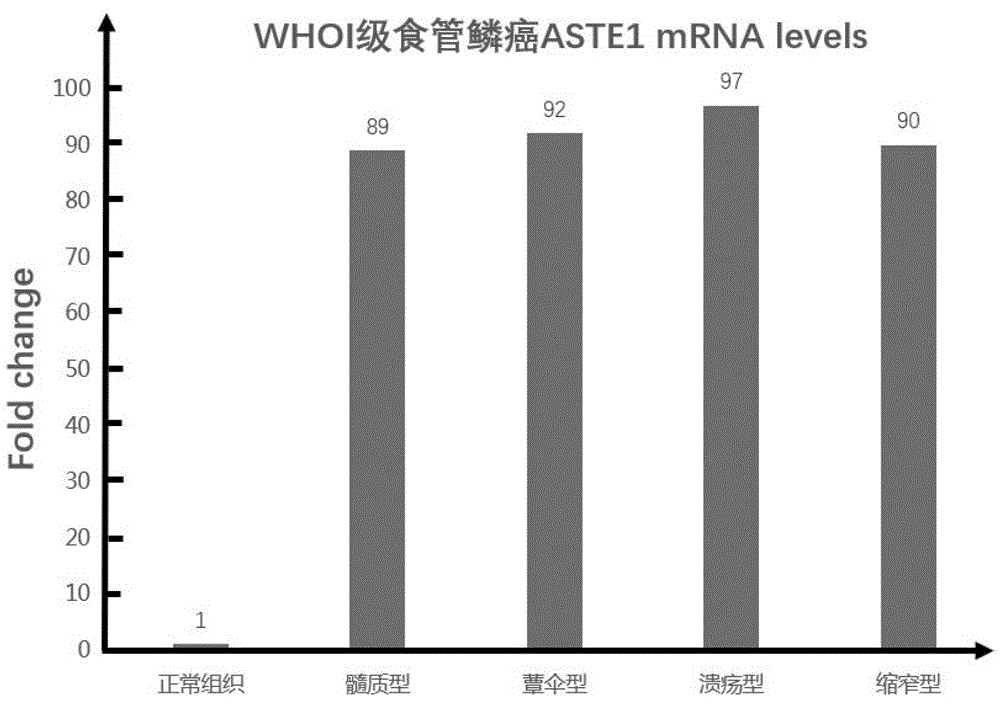 在中国,河南省林州市是中国,也是世界上食管癌发病率和死亡率最高的