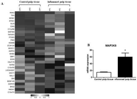 MAP3K8检测试剂在制备牙髓炎筛查试剂盒及抑制剂在制备治疗牙髓炎的药物中的用途的制作方法