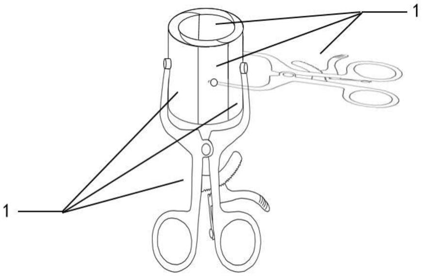 胸腹腔镜手术可扩张标本取出器的制作方法