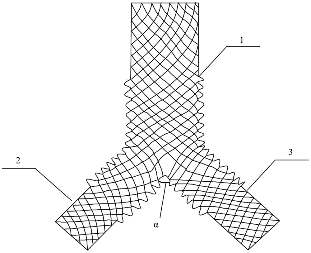 一种Y型一体波纹化网状编织气管支架及其制作方法与流程
