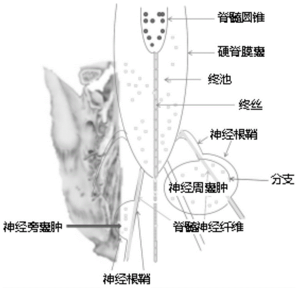 一种建立单向阀门漏口型骶管囊肿大鼠模型的方法与流程