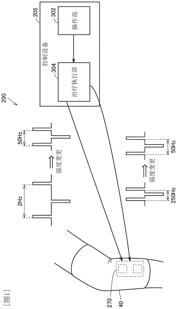 电疗仪以及治疗系统的制作方法