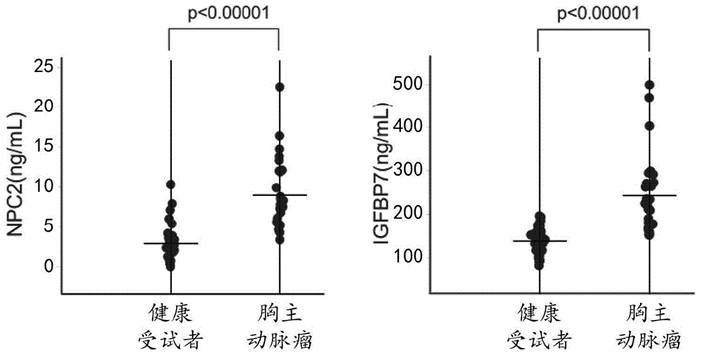 新型主动脉瘤标志物的制作方法