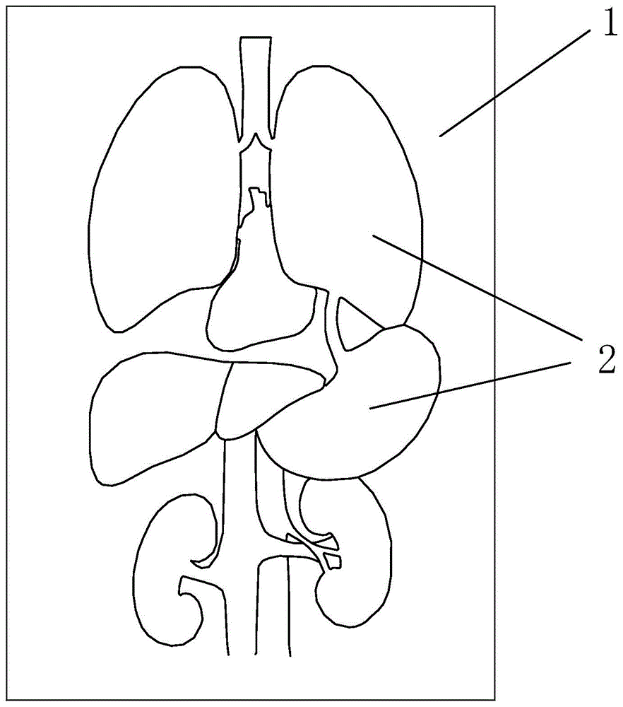 一种超声定位穿刺模拟器的制作方法