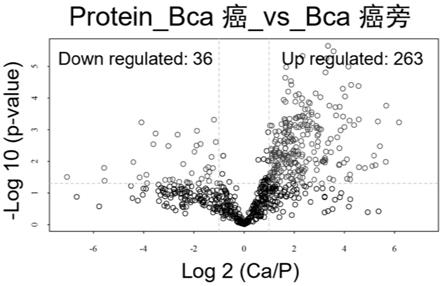 检测样本中标志物表达水平的试剂在制备用于检测或诊断乳腺癌的试剂盒中的应用的制作方法