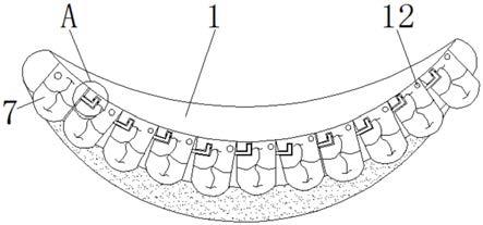 一种临时牙的就位结构的制作方法