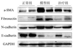 一种治疗肾病的组合物、颗粒剂及制备方法与流程