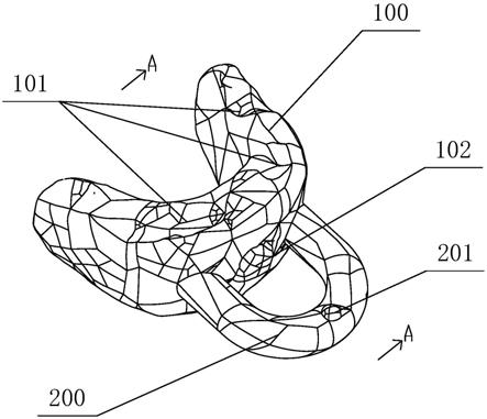 一种放疗牙套的制作方法