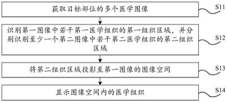 图像显示方法及相关装置和电子设备、存储介质与流程