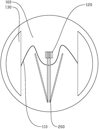 缝线固定器的制作方法