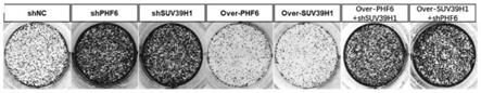 CX-5461在制备PHF6突变的急性髓系白血病的药物中的应用