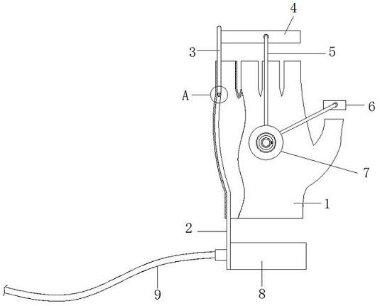 一种类风湿关节炎手指尺侧偏斜矫正器的制作方法