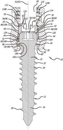 具有3D打印组件的椎弓根螺钉组合件的制作方法