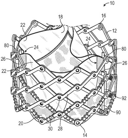 假体心脏瓣膜小叶合缝组件和方法与流程