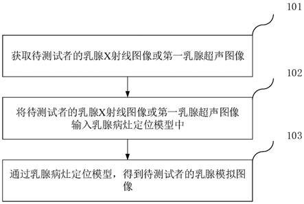 乳腺病灶定位方法、装置、计算机设备和存储介质