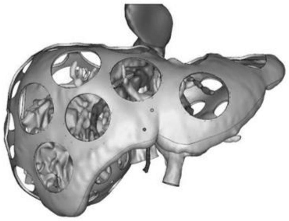 术前规划及术中导航用3d打印简易肝脏模型及制作方法