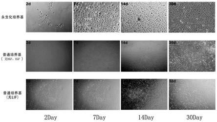 一种肝卵圆细胞永生化培养基及其制备方法和应用与流程