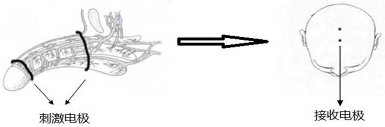 一种基于体感诱发电位信号的阴茎背神经检测方法