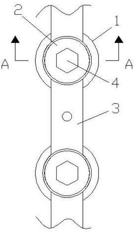 一种脊柱防滑钉棒内固定系统的制作方法