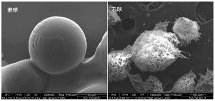 一种基于可溶性淀粉的栓塞微球及其制备和应用