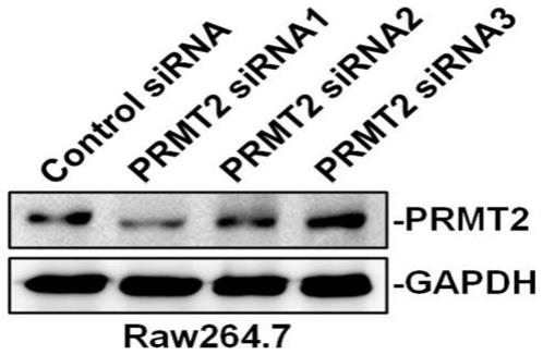 下调PRMT2基因表达的siRNA及其应用的制作方法