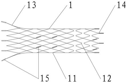 一种颅内动脉瘤栓塞辅助支架及输送系统的制作方法