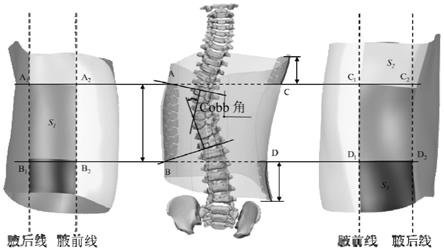 一种用于脊柱侧凸矫形器的矫形区域划分方法及系统与流程