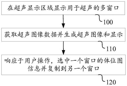 一种用于超声的多窗口显示方法和超声成像系统与流程