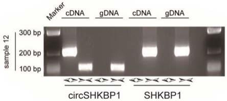 circSHKBP1作为非小细胞肺癌诊断标志物的应用的制作方法