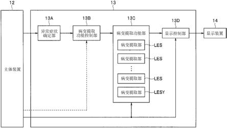 诊断辅助装置、诊断辅助方法以及程序与流程