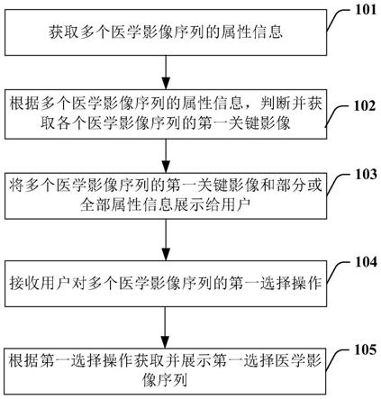 医学影像加载方法、系统、计算设备和计算机可读介质与流程