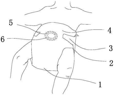 一种具有婴儿肚脐窗口设计的尿裤的制作方法