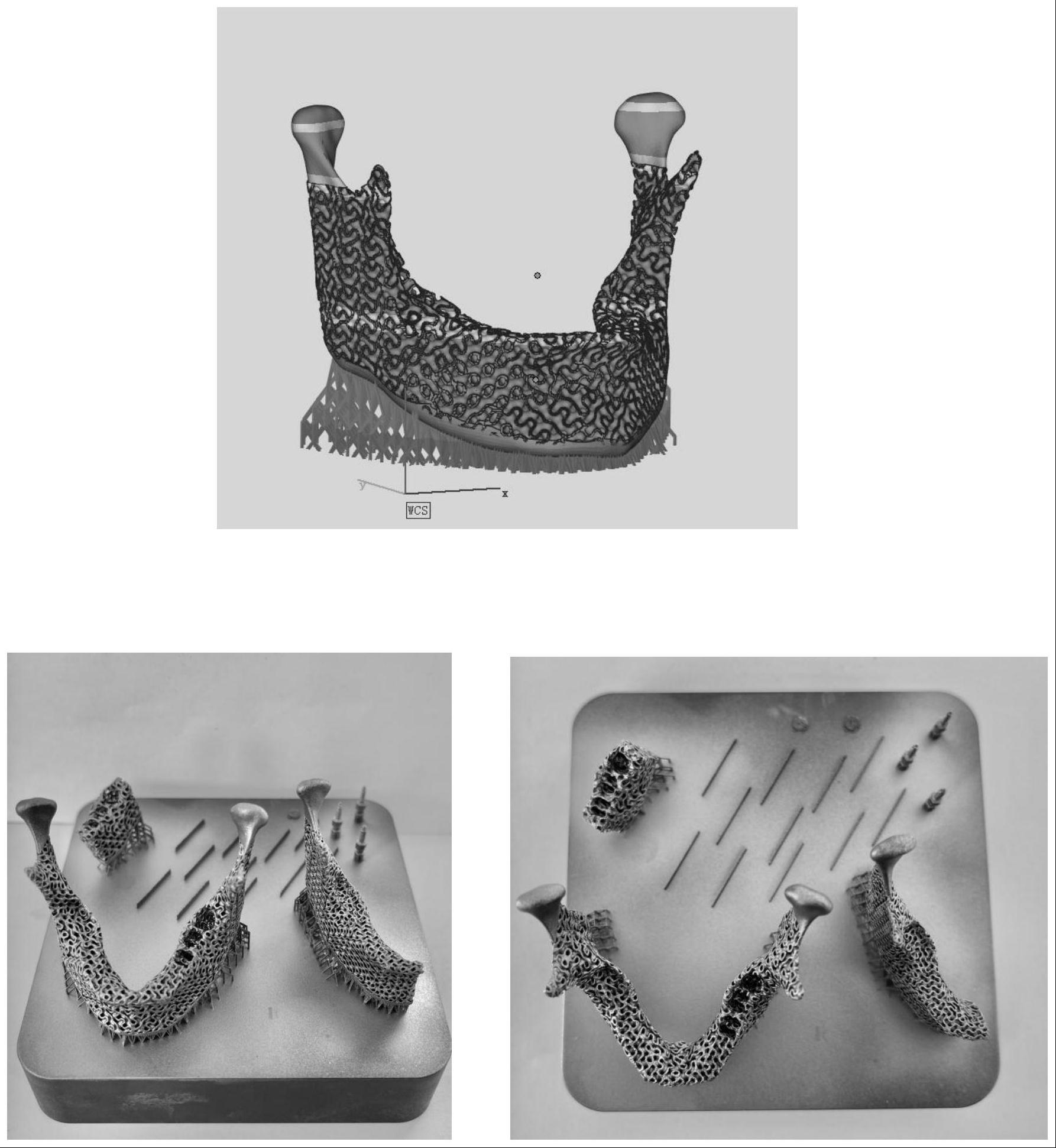 一种3D打印基于TPMS设计的仿生下颌骨支架的制备方法与流程