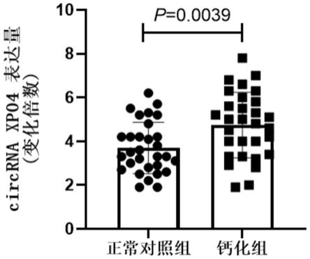 circRNAXPO4在人主动脉瓣膜间质细胞成骨分化中的应用