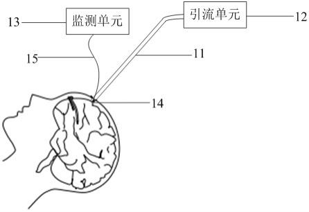 一种颅内导流及颅内压监测一体化装置的制作方法