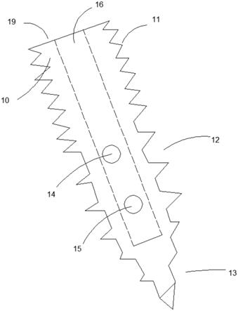 疏密相间螺纹的骨牵引针的制作方法