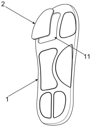 根据运动步态及足部3D扫描分析定制的鞋垫以及纠正鞋的制作方法