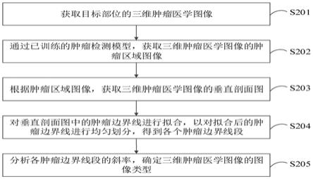 肿瘤图像智能分类方法、装置和医学图像处理设备