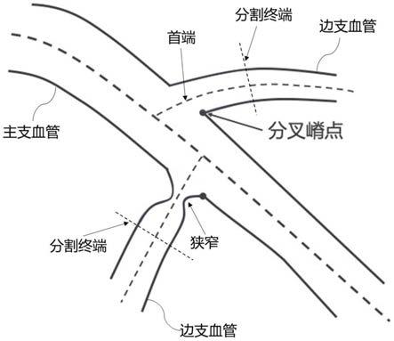 用于血管造影图像处理的训练方法和装置、自动处理方法和装置与流程