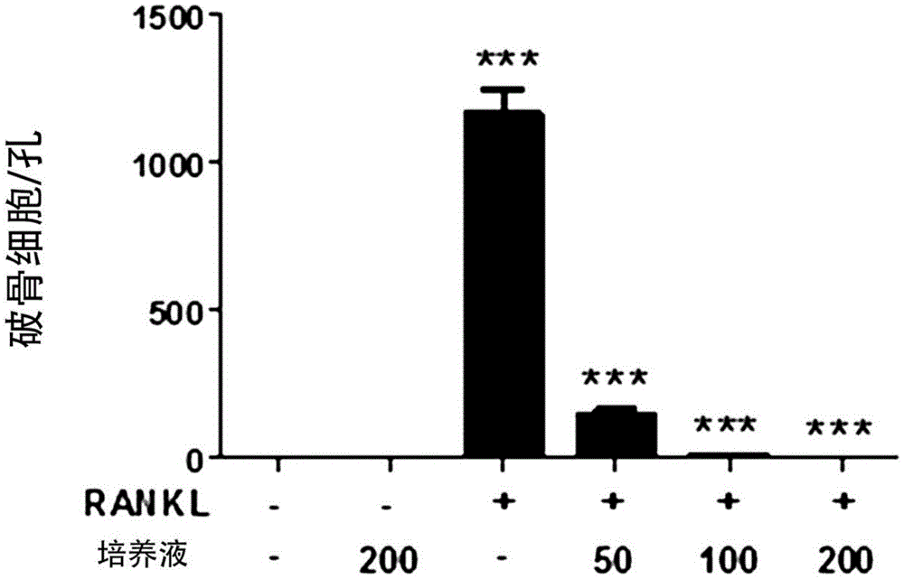 含新型沙克乳酸杆菌CVL-001菌株或其培养液的用于改善、预防或治疗骨病或代谢性疾病的组合物