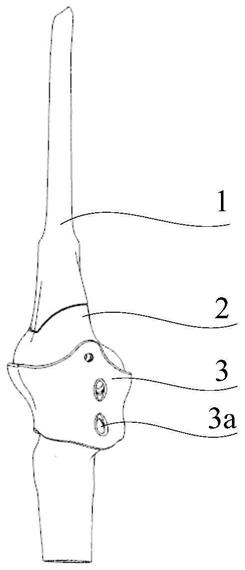 一种膝关节防脱位装置的制作方法
