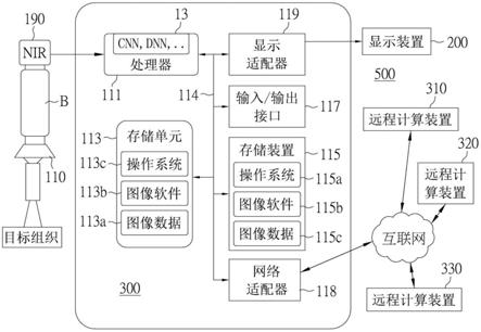 评估甲状旁腺存活率的系统的制作方法