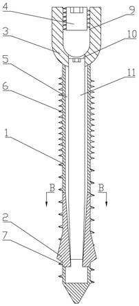 椎弓根螺钉、撑开棒、加热棒和椎弓根钉系统的制作方法