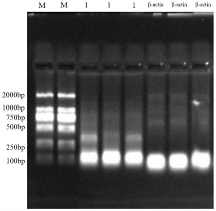 微滴数字PCR检测前列腺癌组织中CTHRC1基因含量的方法与流程