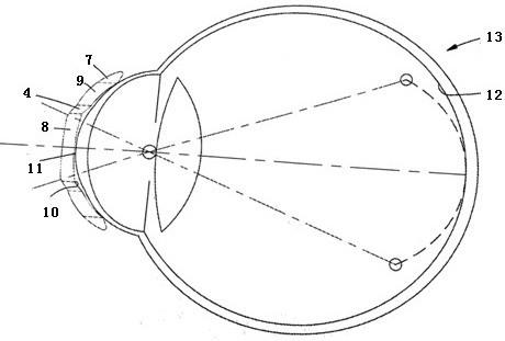 能控制近视进展的角膜塑形镜的制作方法